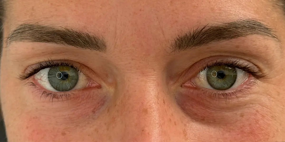 Augenpartie einer Kundin vor und nach dem Wimpernlifting (vorher)